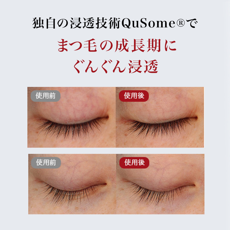 独自の浸透技術でまつげの成長期にぐんぐん浸透