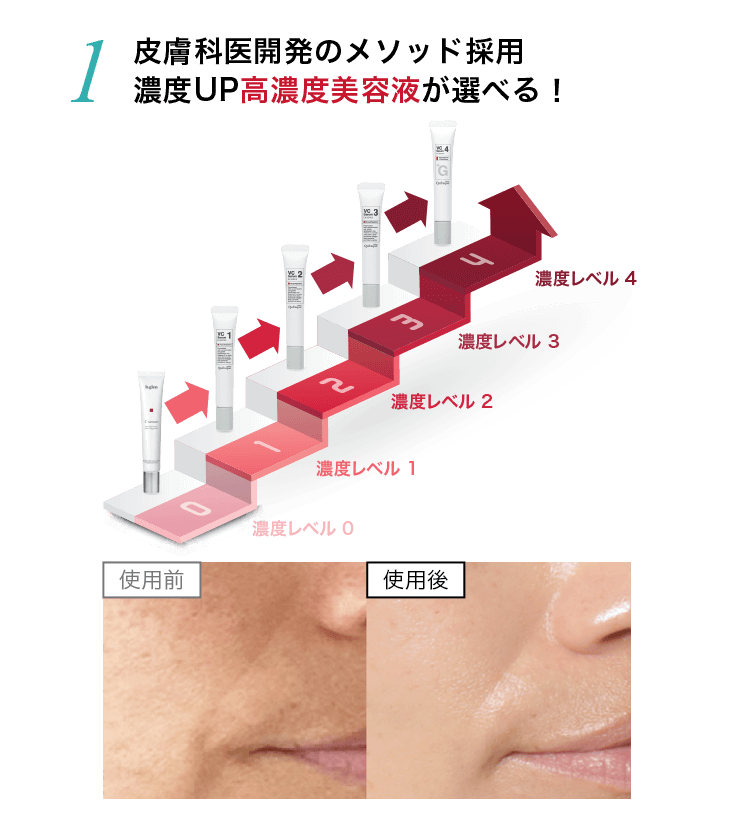 １、皮膚科医開発のメソッド採用、濃度UP高濃度美容液が選べる！