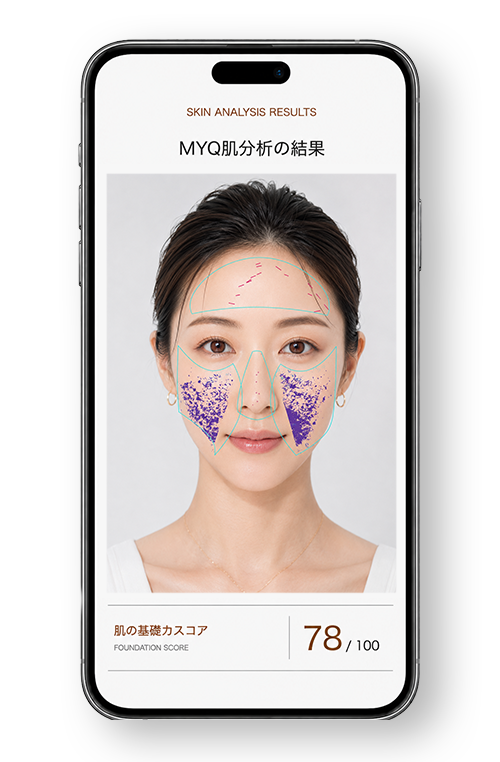 MYQ肌分析の結果画面。肌の基礎力スコアと、部位ごとの分析が表示される