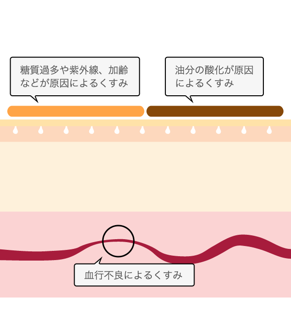 血行不良によるくすみ