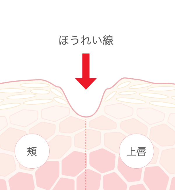 ほうれい線