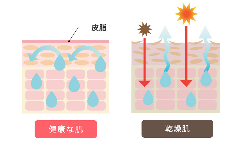 肌の「乾燥」はあらゆる肌トラブルの元