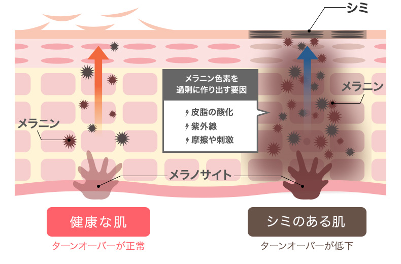 シミの正体は「メラニン」