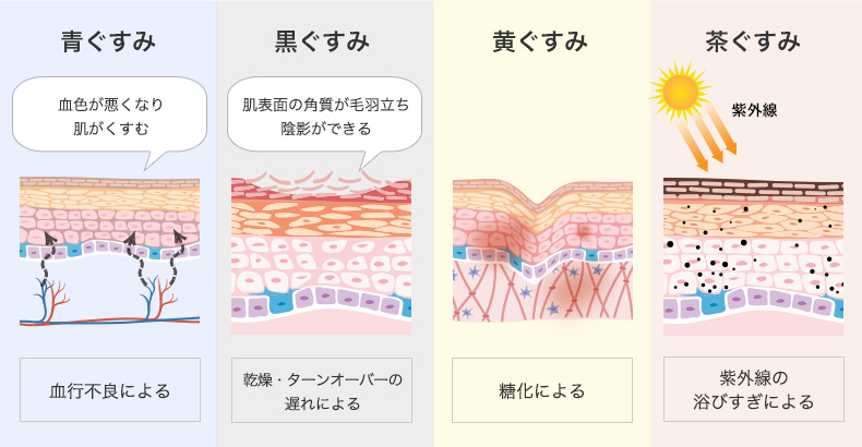 くすみの種類4種類