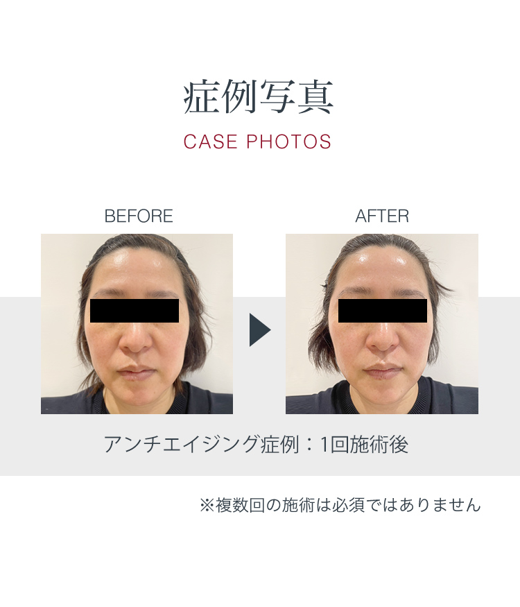 症例写真