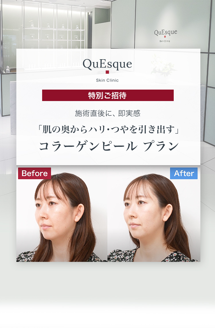 「肌の奥からハリ・つやを引き出す」コラーゲンピール プラン