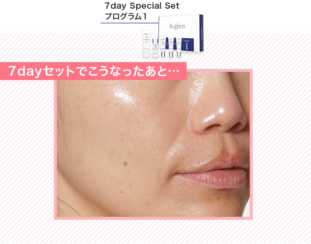 7dayセットでこうなったあと…