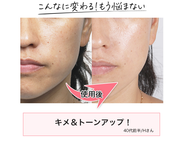 こんなに変わる！もう悩まない
