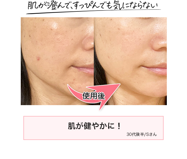 肌が澄んで、すっぴんでも気にならない