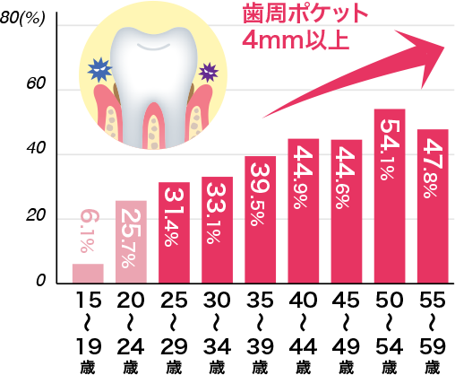歯周ポケット（歯と歯茎の隙間）が深くなり始める20代から始めたい歯周病対策