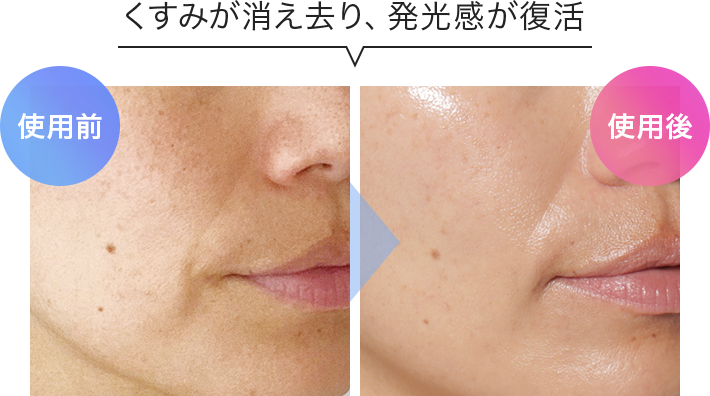 くすみが消え去り、発光感が復活